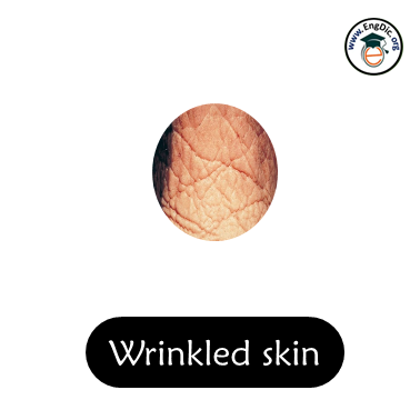 wrinkled skin